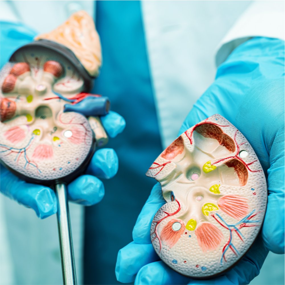 hands holding models of two kidneys